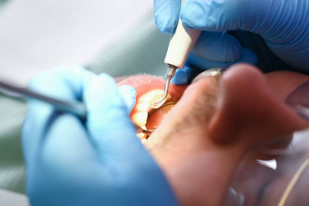 Best Emergency Wisdom Teeth Removal in Kenhorst, PA