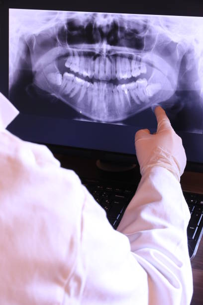 Best Emergency Dental Care for Broken or Chipped Teeth in Kenhorst, PA