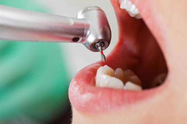 Best Emergency Tooth Extraction in Kenhorst, PA